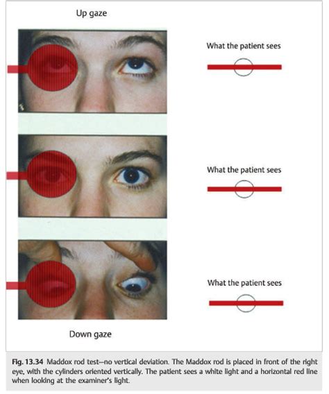 horizontal for attention vertical for results|Eye.